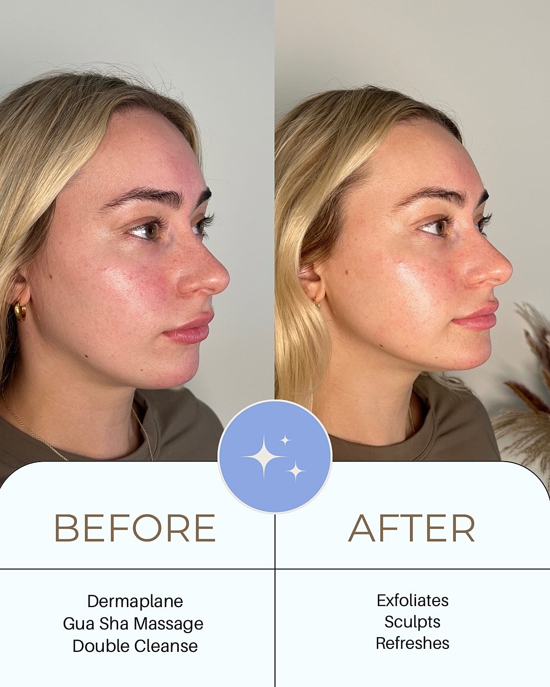 Skincare transformation: before and after treatment.