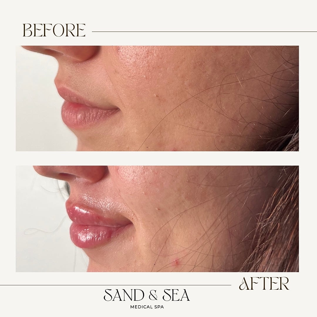 Before and after skincare treatment results.