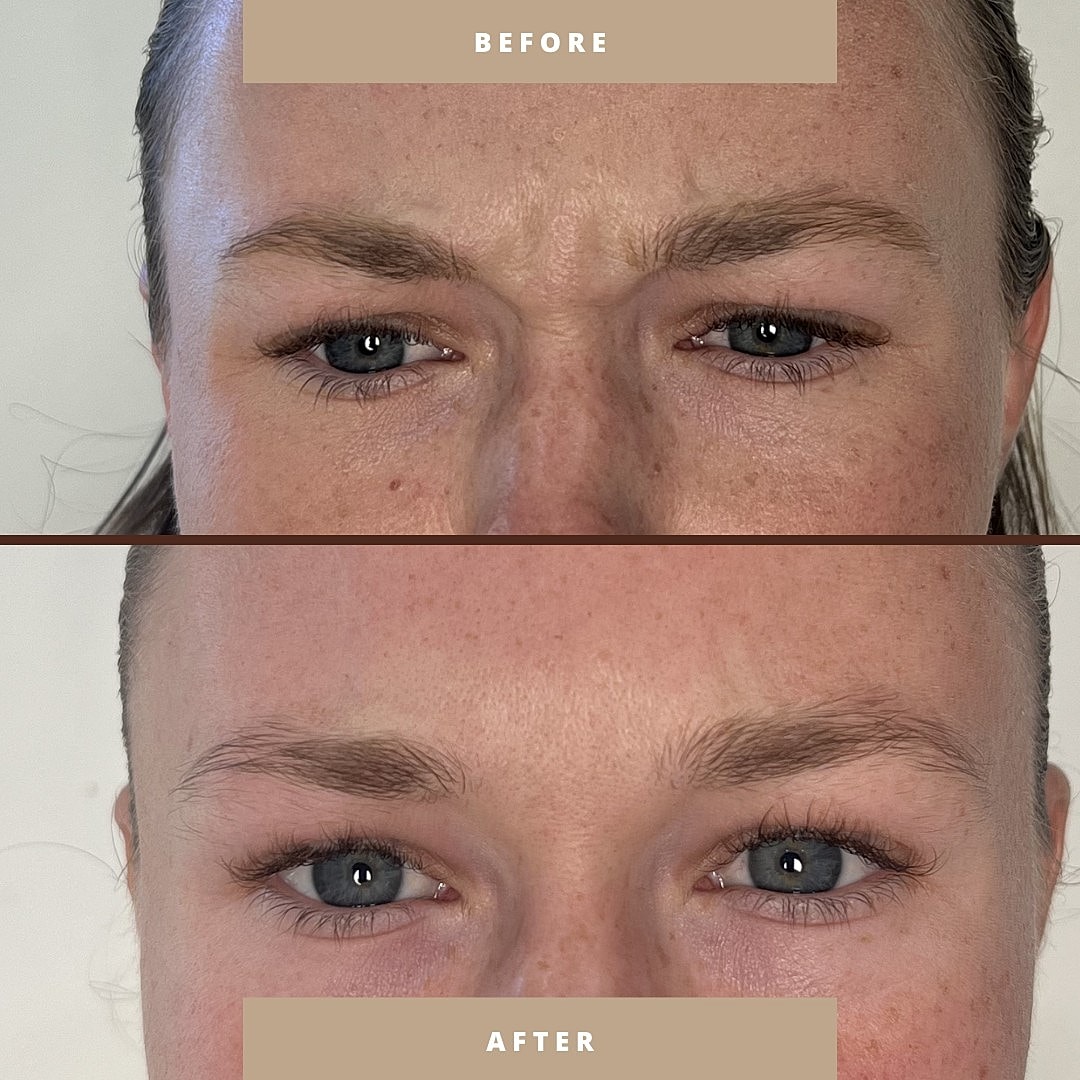 Before and after cosmetic enhancement comparison.