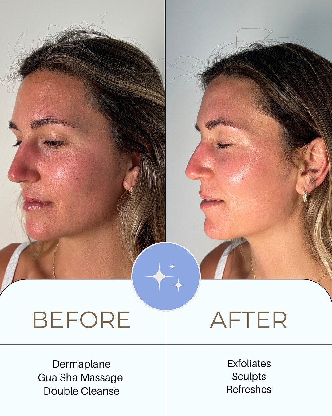 Facials Before & After